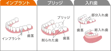 各治療法の特長と注意点
