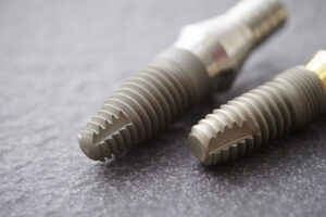 インプラントのフィクスチャーとは？素材・種類や埋入方法を解説