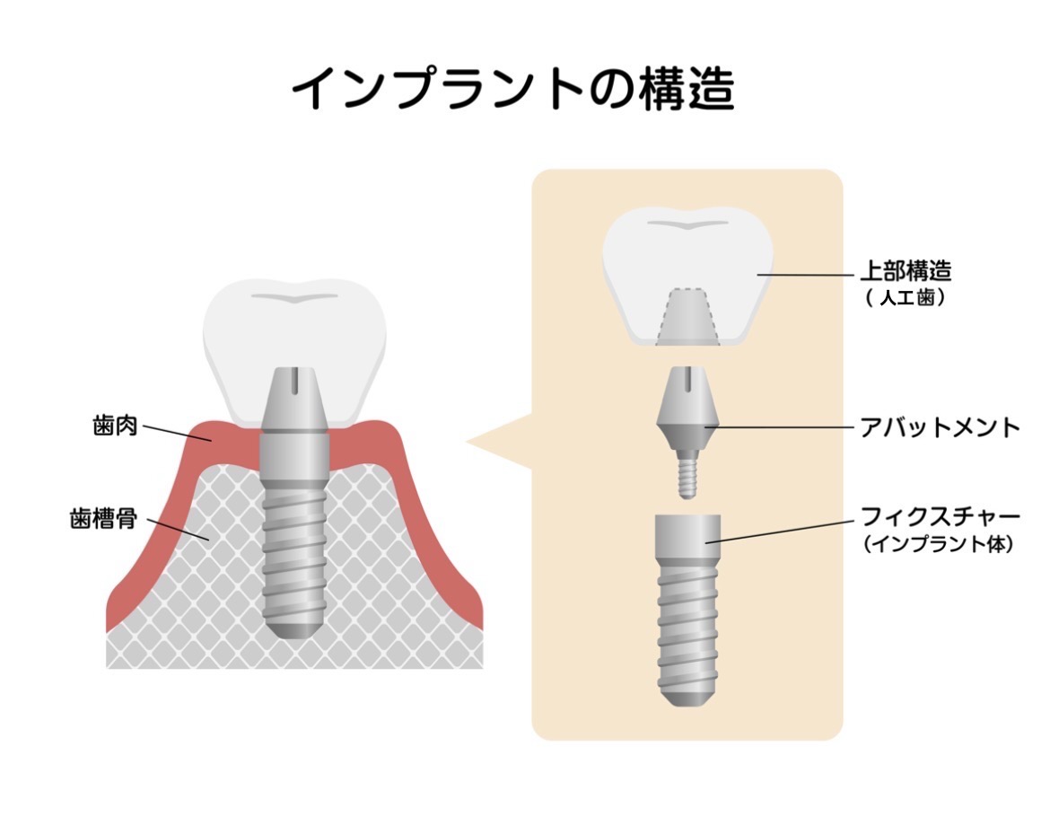 コラム画像
